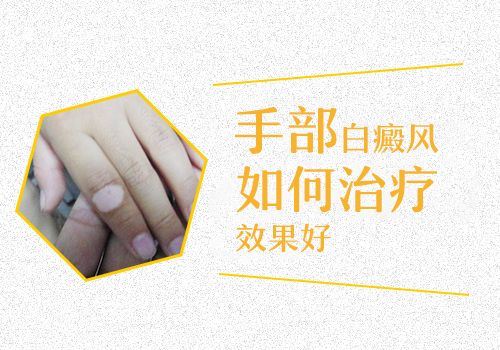 白斑患处皮肤可以热敷吗